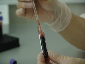 카이노스메드, 중국서 에이즈 치료제 임상 3상 돌입
